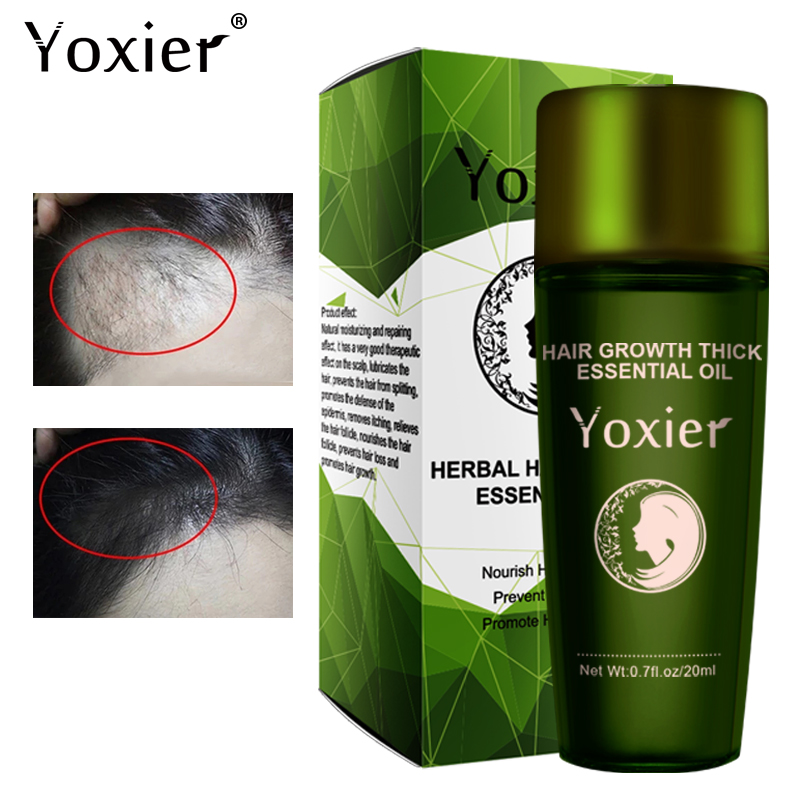Hair Care Herbal Products - Yoxier-Aceite esencial de hierbas para el