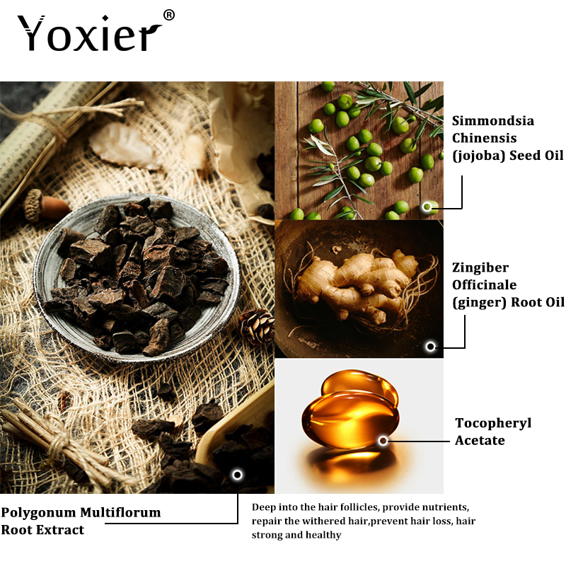 Yoxier-Aceite esencial de hier - Hair Care Herbal Products reseña y precio