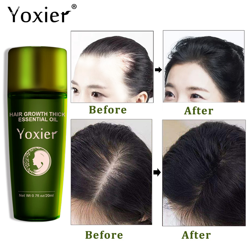 Yoxier-Aceite esencial de hier - Hair Care Herbal Products reseña y precio