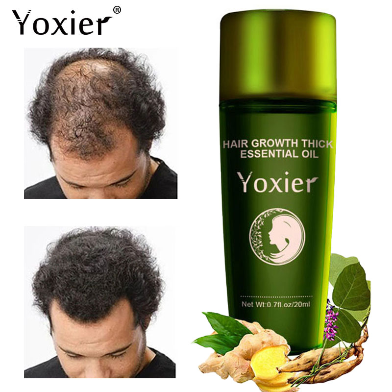 Yoxier-Aceite esencial de hier - Hair Care Herbal Products reseña y precio
